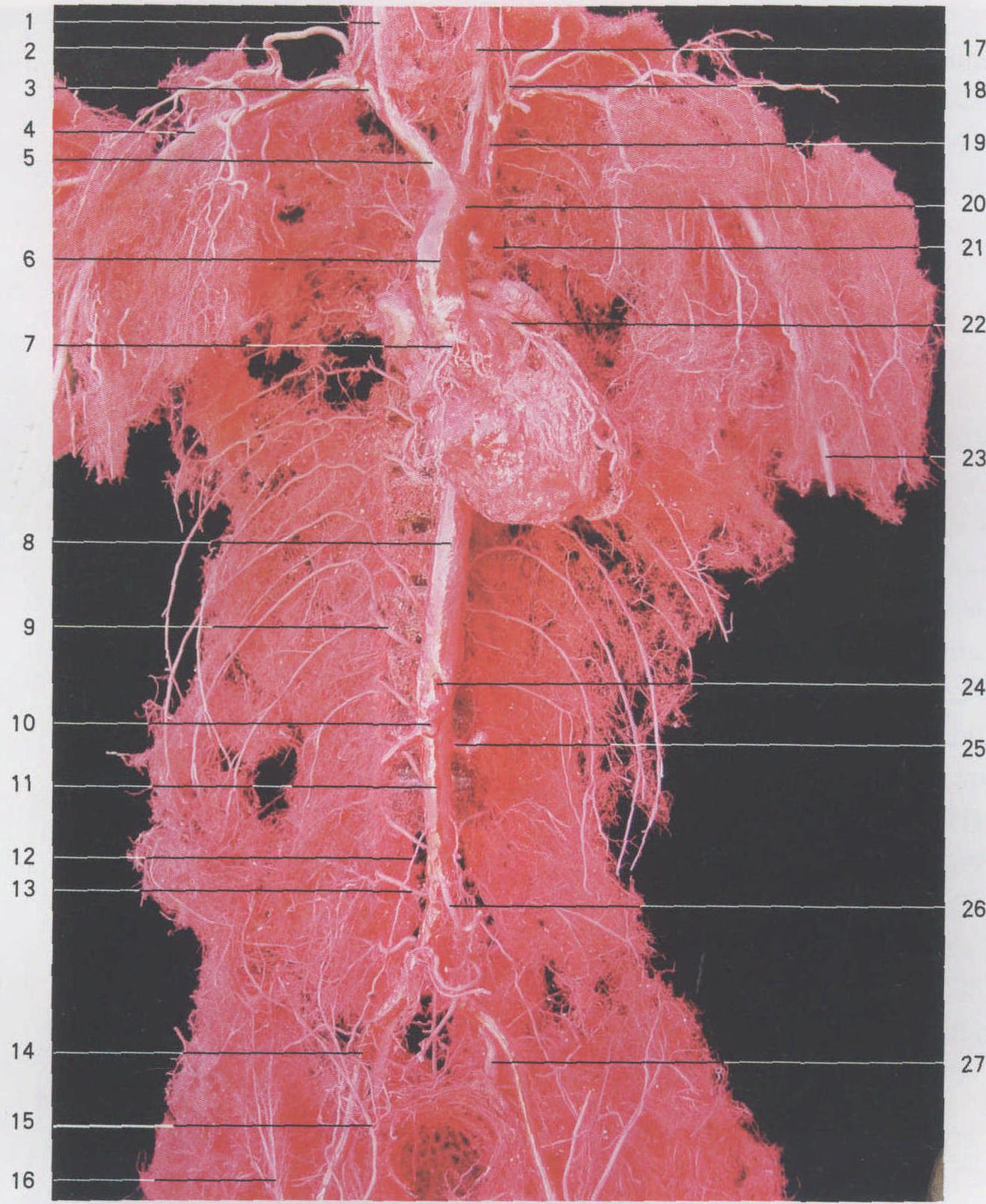 Ⅰ-7 主動脈及其分支(前面觀)(鑄型標本)